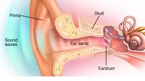 Hearing Loss